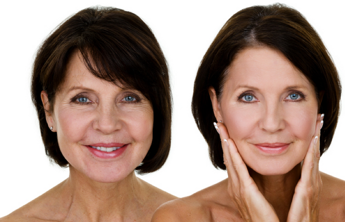 The 4 Different Wrinkle Types and How to Treat Each One